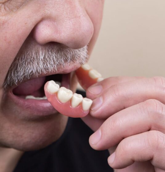 Patient fitted for complete dentures in Towson MD at Smithberger DDS